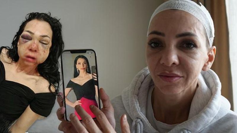 İzmit'te Bayram Günü Yaşanan Şiddet Olayında Yaralanan Anne Hukuk Mücadelesini Sürdürüyor