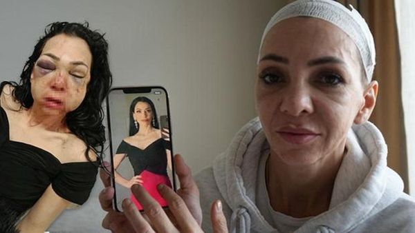 İzmit'te Bayram Günü Yaşanan Şiddet Olayında Yaralanan Anne Hukuk Mücadelesini Sürdürüyor