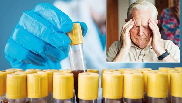 Kan Testiyle Alzheimer Erken Teşhisinde Yeni Gelişmeler