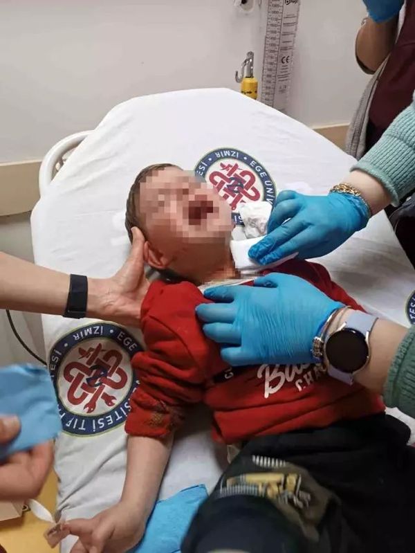 İzmir’de 2 Yaşındaki Çocuğa Bıçaklı Saldırı: Şüpheli Yakalandı