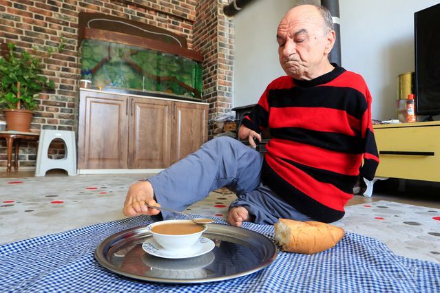 Elleri Olmadan Hayatın Tüm Zorluklarını Aşan Mehmet Amca'nın İlham Veren Hikayesi