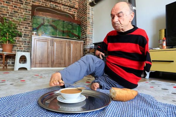 Elleri Olmadan Hayatın Tüm Zorluklarını Aşan Mehmet Amca'nın İlham Veren Hikayesi