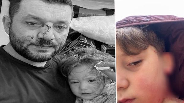 Çınarcık'ta Husumet Derinleşiyor: Muhammet Baca ve Oğlu Yaralandı, Tehditler Sürüyor