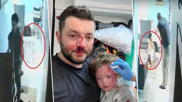 14 Aylık İkra ve Babasının Darbedilmesiyle İlgili İddianame Tamamlandı