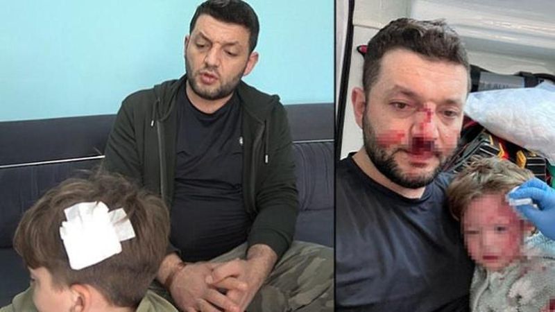 Yalova'da Aileye Yönelik Saldırılar ve Taşlı Saldırı Sonrası Güvenlik Endişeleri Artıyor