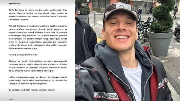 Edis'in Uyuşturucu Testi Pozitif Çıktı, Sanatçı İlk Açıklamasını Yaptı