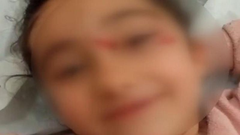 Eyüpsultan'da Okuldan Dönen 6 Yaşındaki Çocuğa Başıboş Köpek Saldırısı