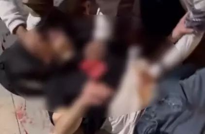 Yenimahalle Metro Çıkışında Kavga: 2 Yaralı, 3 Şüpheli Gözaltında