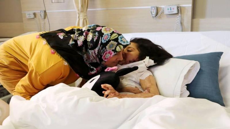 Mersinli 5 Yaşındaki Gülsah'ın Çenesi Boynundan Başarılı Operasyonla Ayrıldı