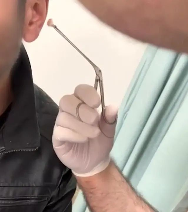 Kayseri'de Kulak İçine Uyuşturucu Saklayan Şüpheli Yakalandı