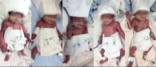 Wuhan'da Nadir Görülen Beşiz Doğum Başarıyla Gerçekleşti