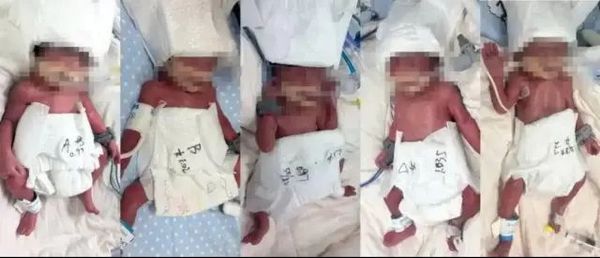 Wuhan'da Nadir Görülen Beşiz Doğum Başarıyla Gerçekleşti