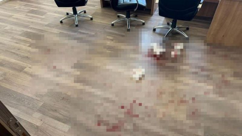 Yozgat'ta Okul Müdürüne Saldıran Zanlı Tutuklandı