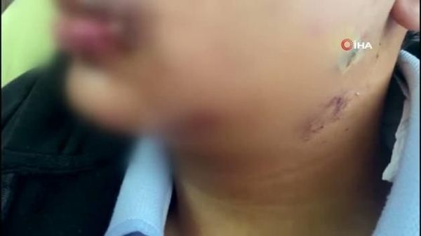 Antalya'da Okulda Akran Zorbalığı: 'Kalkar mısın' Uyarısı Çeneyi Kırdı