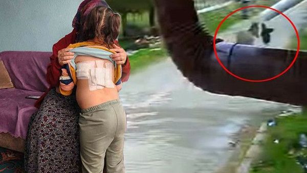 4 Yaşındaki Kız Çocuğuna Eşeğin Saldırısı Kamerada Kaydedildi