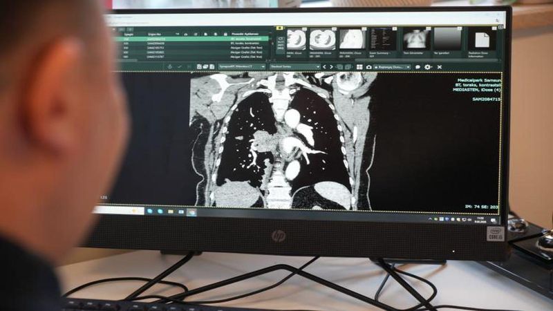 Prof. Dr. Şevket Özkaya’dan Kanser ve Yaşlanma İlişkisi Hakkında Önemli Açıklamalar