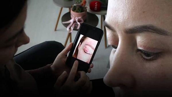 Diyarbakır'da 1100 TL'lik Güzellik İşlemi Sonrası Gözde Kalıcı Hasar İddiası