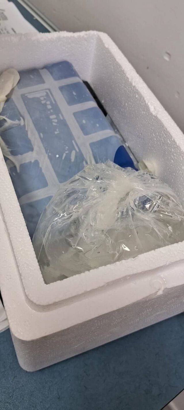 Manisa'da Sahipsiz Köpeklerin Saldırısı Sonrası Adamın Parmağı Koptu