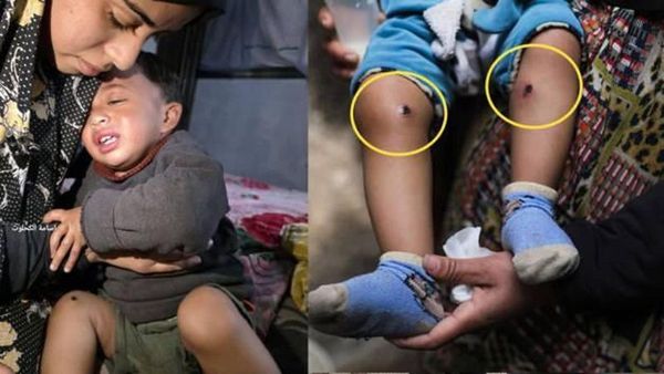 İsrail Askerlerinin 18 Aylık Bebeğe İşkence Yaptığı İddiası Gazze'de Gündem Oldu