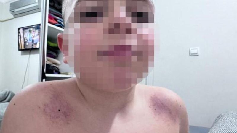 Antalya'da İlkokulda Darp İddiası: Aile Öğretmenden Şikayetçi Oldu