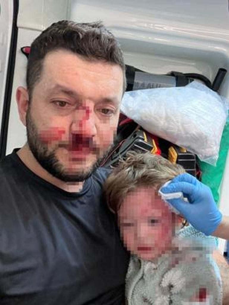 14 Aylık Bebeğin Kafatası Çatladı: Yalova'daki Komşuluk Kavgasında Yeni Gelişmeler