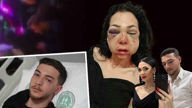 İzmit'te 'Kadınlar Var' Uyarısı Sonrası Anne ve Oğluna Şiddetli Saldırı