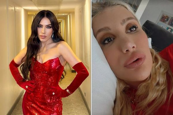 İrem Derici, Burcu Güneş'e Barış Mesajı Gönderdi: Sürekli Kavga Etmekten Yoruldum