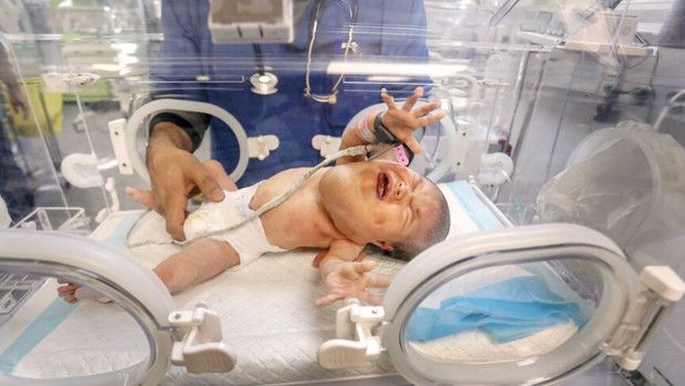 Gazze’de Bebek Maması Krizi Derinleşiyor: Binlerce Bebek Yetersiz Besleniyor