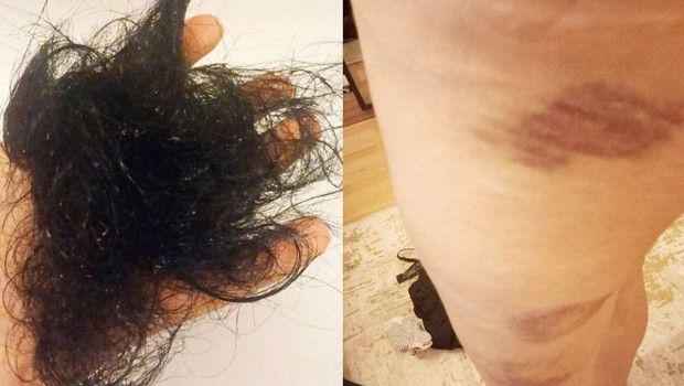 Antalya'da Darp ve Takip İddialarında Jandarma Kararları Tartışma Yarattı